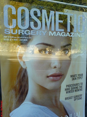 Complications of Plastic Surgery