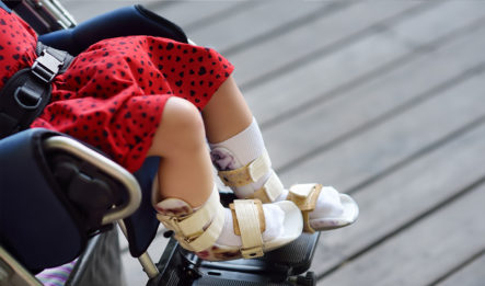 A young child in a stroller wears leg braces as a demonstration of developmental delays and cerebral palsy in babies.