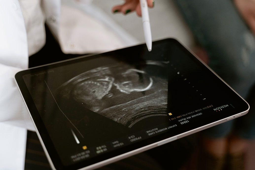 A doctor points to an ultrasound image on an iPad to discuss the injuries that will later lead to a birth defect lawsuit